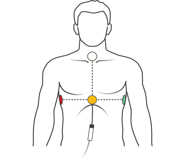 Abbildung der Elektrodenposition am Oberkörper