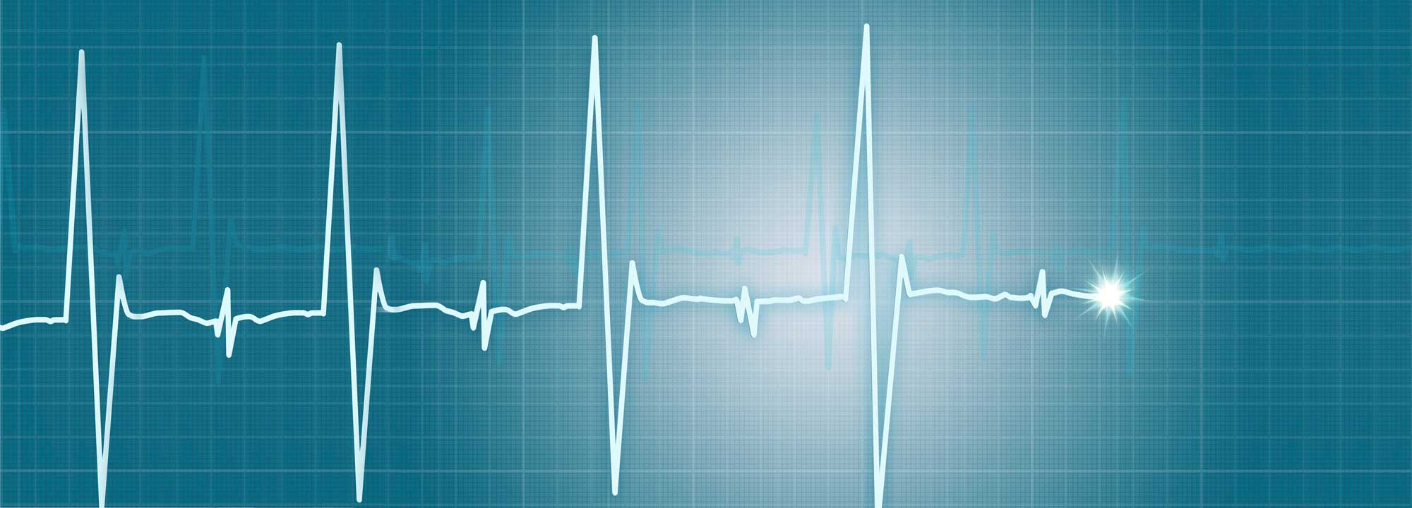 ECG-Curve