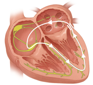 Diagram of electrical impulses in the heart muscle