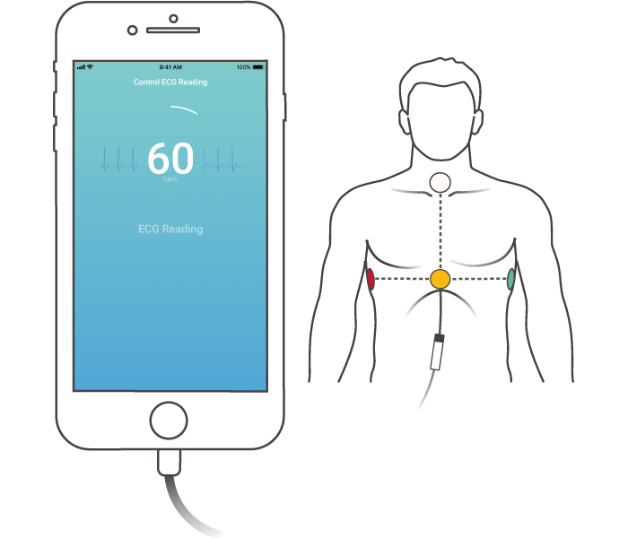 Starten der 10 Sekunden EKG Messung in der CardioSecur Active App